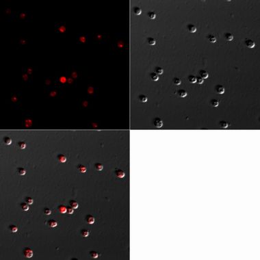 写真：ラン藻の細胞内に蓄積されたPHA